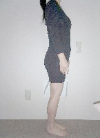 健友館きむら整体院骨盤美容矯正後